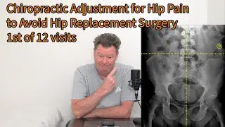Chiropractic Adjustment for Hip Pain to Avoid Hip Replacement Surgery- 1st of 12 visits