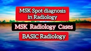 MSK Cases  - Radiology - Spot diagnosis