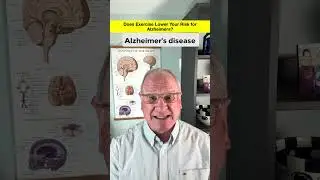 Does exercise reduce the risk for Alzheimer's disease? | Fitness Facts