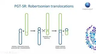 Demystifying PGT-SR: Insights and answers to your queries