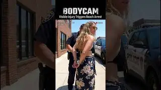 Bodycam: Visible Injury Triggers Beach Arrest
