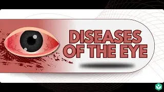 Diseases of the Eye | Sense Organs | Class 9 | Biology | Telangana | Khan Academy