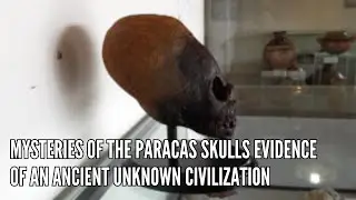 Mysteries of the Paracas Skulls Evidence of an Ancient Unknown Civilization