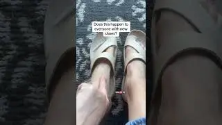 I am loving my Crocs Getaway toe loop sandals but the blister they gave me breaking them in is rough