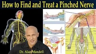 How To Find and Treat a Pinched Nerve (Simple Neurology) - Dr Mandell