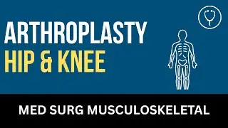 Arthroplasty  -  Hip and Knee - Nursing Lecture - Chapter 36