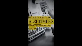 Blood Tests For Alzheimers