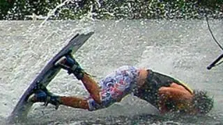 WAKEBOARDER FALLS ON FACE! (7.27.10 - Day 453)