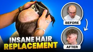INSANE STRAIGHT HAIR REPLACEMENT🤯 (LIFE CHANGING)
