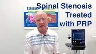 Testimonial  -  Spinal Stenosis Treatment with PRP