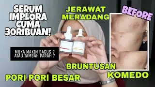 Sebelum Beli Liat Review Ini Dulu Dikulit Berjerawat | Review Jujur Serum Implora Acne & Peeling