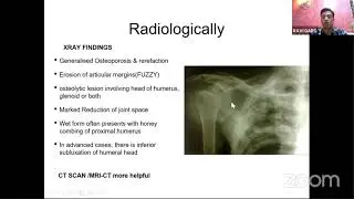 Caries Shoulder - Dr  Ravi Garg
