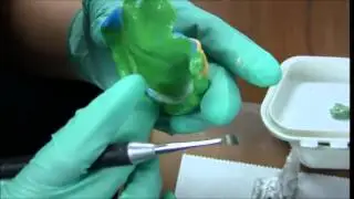 Pala Digital Dentures Scanning Process - Maxillary Scanning