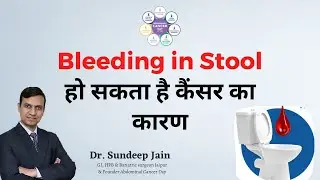 Bright red blood in the stool | Dr. Sundeep Jain | Abdominal Cancer Day