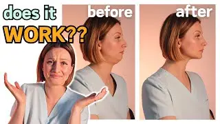 Mewing Explained: Does It Really Work?