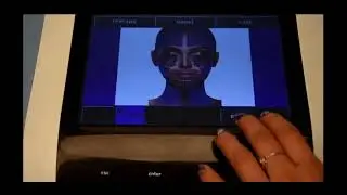 EXILIS ELITE BTL Operation Video