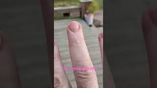 a black lab bit me #funny #puppies #pets #rescuedog #dog #pitbull #comedy #cute #puppy #gsds