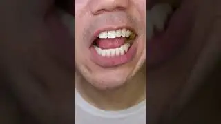 Maynards Wine Gums Roll #DoctorTristanPeh #ASMR #Shorts