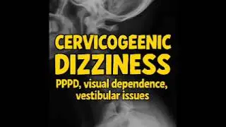 Cervicogenic dizziness Case Study | PPPD | Vestibular issues | Visual dependence