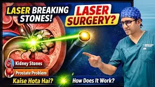 Holmium Laser Surgery Explained. Laser Treatment for Kidney Stones & Prostate