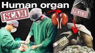 Незаконная торговля человеческими органами в Индии 💰 | @doctorduo