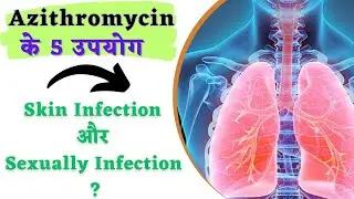 azithromycin 500 mg tablet uses | antibiotics for infection | Azithro 500 mg