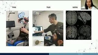 OHBM 2025 | Symposium | Marilyn Gatica | High-order neuromodulation of transcranial ultrasound sti&hellip;