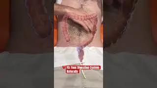 Fix Your Digestion System Naturally