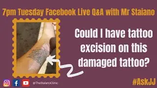 #ASKJJ - Could I have tattoo excision on this damaged tattoo?