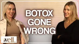 When Botox Goes Wrong 😬 | What I Learned After My Smile Dropped (Real Experience & Recovery Journey)