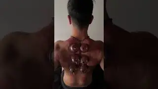 Attivazione dei muscoli nella schiena con le coppette per info (3661369122)