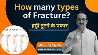 Common types of Bone fracture | Types of Fracture | How many types of Fracture #fracture