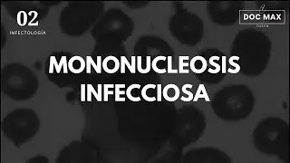 MONONUCLEOSIS INFECCIOSA - ENARM