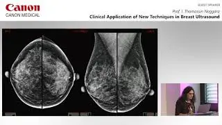 ECR 2019 Symposium - Clinical Value of Ultra High Frequency in Breast Ultrasound