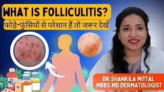 फोड़े फुंसी का कैसे करें इलाज - MBBS MD (MAMC) (स्किन)- हिंदी २०२३
