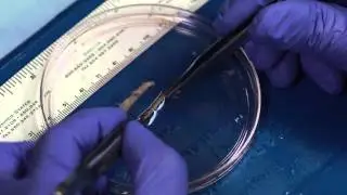 Dissection of a Partial Ovary in Preparation for Cryopreservation