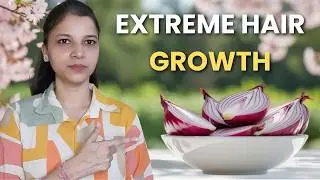 Onion Juice for Extreme Hair Growth: Stop Hair Loss || By preetibella