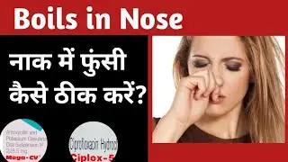 Boils in nose | naak me funsi ka ilaj in hindi