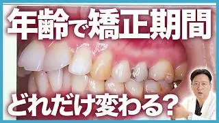 30代の歯列矯正は遅い？抜歯・非抜歯で比べる年齢と矯正期間の本当の関係【審美歯科 歯科矯正 歯並び 口ゴボ】