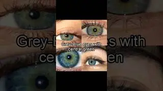 I have central heterochromia eyes 💙💚 #eyes #fypシ゚ #shorts #rare #viral #trend #trending