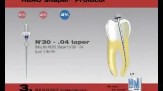 Micro Mega HERO Shaper Rotary Files | pinkblue