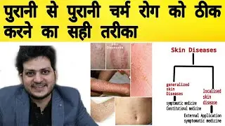 How to Treat Skin Diseases by Homeopathy ? way of treatment | Medicine | Cure |