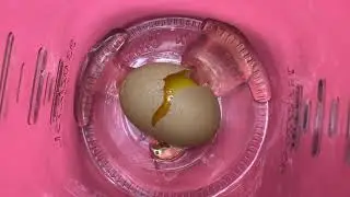 Egg Heads: How Cerebrospinal Fluid Protects the Brain