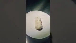 Class II - Mesio- occlusal cavity preparation
