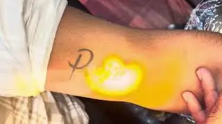 Tattoo Removal in Hyderabad with best Results ☎️9848312719 #pleasesubscribe #youtubevideo #viral