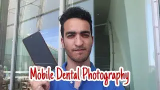 Tips and tricks in mobile dental photography- تصوير الأسنان بكاميرا الموبايل