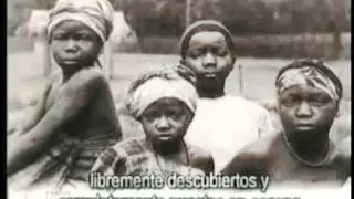 ZOOLOGICOS HUMANOS