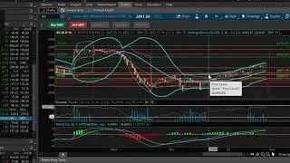 Sunday Stock Talk