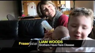 Fraser Focus - Pelizaeus Merzbacher  Disease
