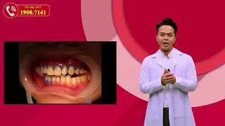 Giải đ&aacute;p tất cả c&acirc;u hỏi về phương ph&aacute;p TẨY TRẮNG RĂNG | NHA KHOA Đ&Ocirc;NG NAM&reg;